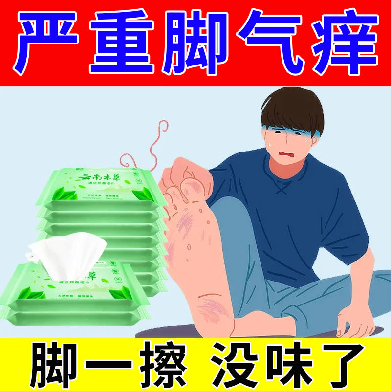 懒人脚气湿巾草本脚痒脱皮水泡烂脚去除脚臭脚汗烂脚护理湿巾专用
