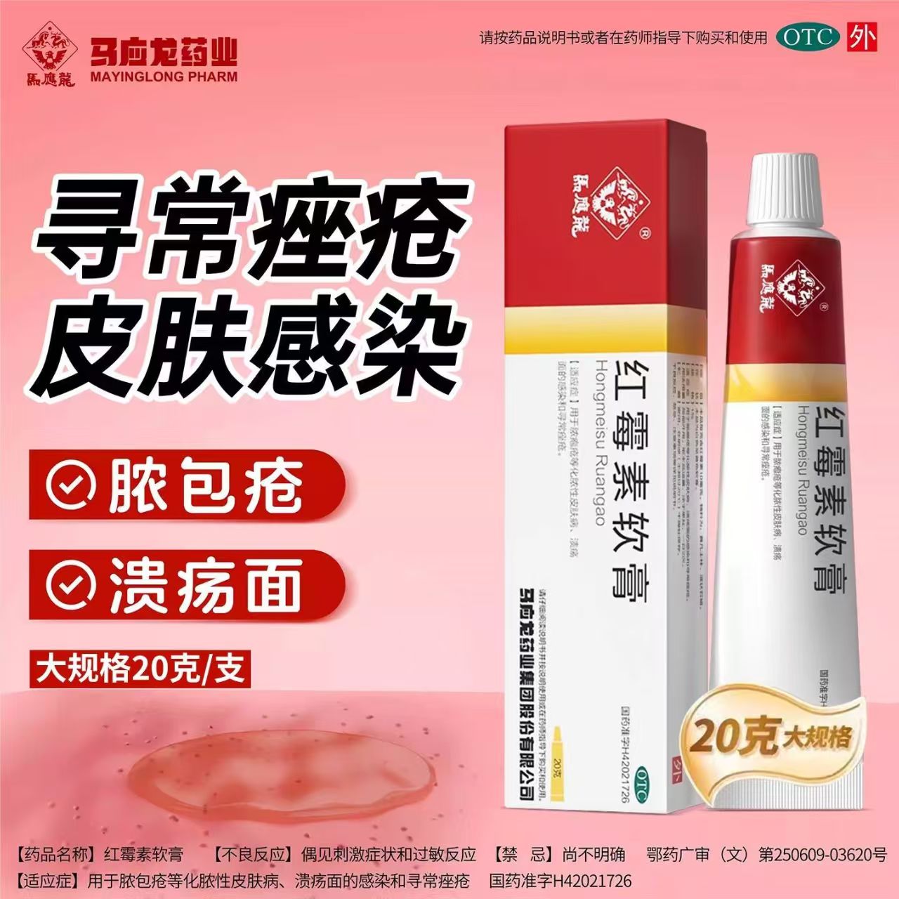 溃疡面感染脓疱疮化脓性皮肤病 寻常痤疮抗菌马应龙红霉素软膏20g