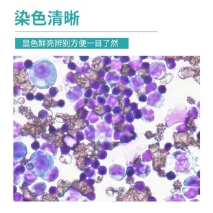 贝索瑞氏姬姆萨染色液瑞士吉姆萨染色剂细胞细菌染色试剂病理染液
