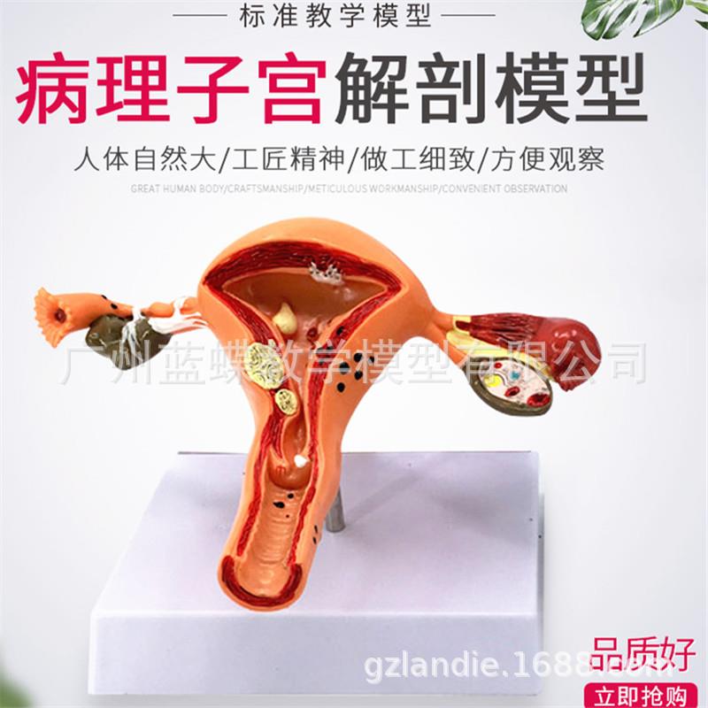人体子宫模型教具模具阴道卵巢解剖病理医学女性仿真女性生殖模器