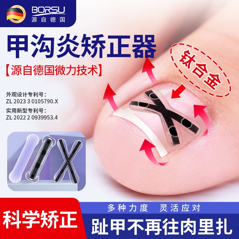 德国BORSU甲沟炎正甲嵌甲贴片脚指甲扎肉矫正器