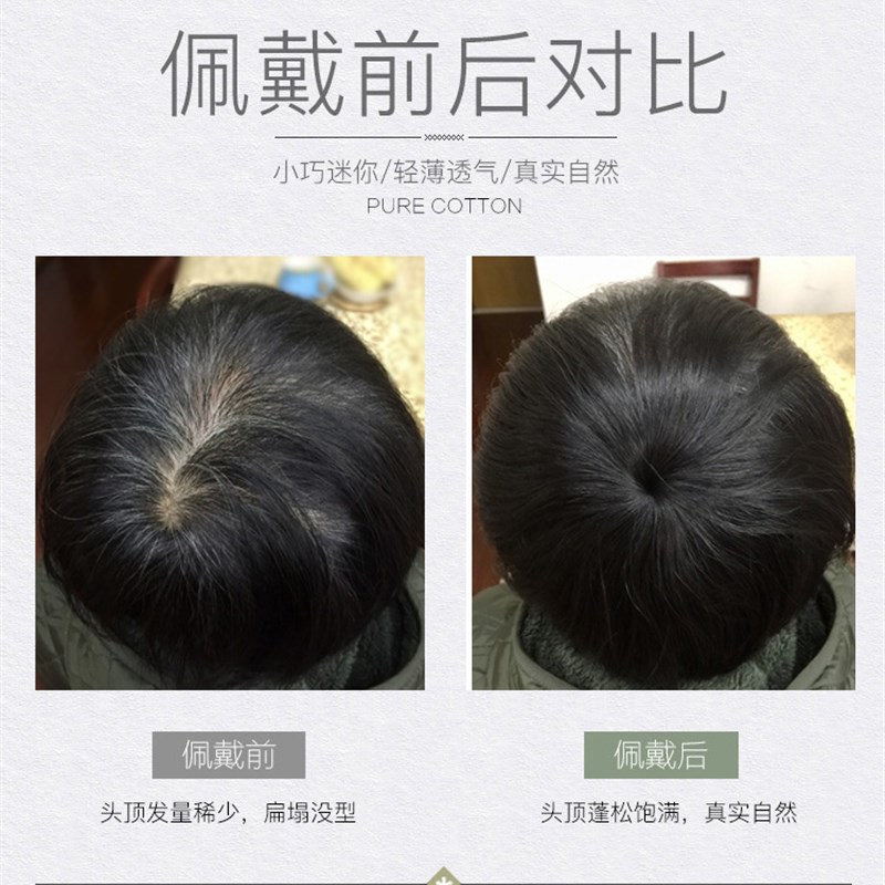 假发片真发头顶补发片女蓬松补发块一片式隐形无痕发顶遮头旋白发