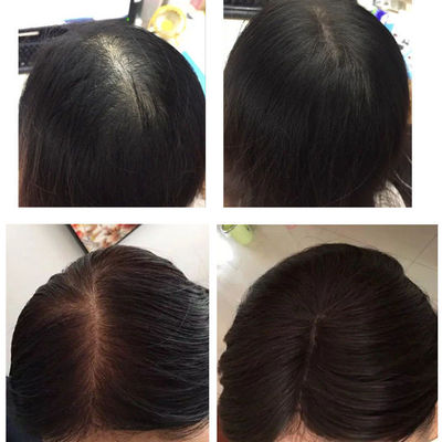 袋装toppik顶丰密发增发男女补发神器假发浓密头发蛋白纤维粉