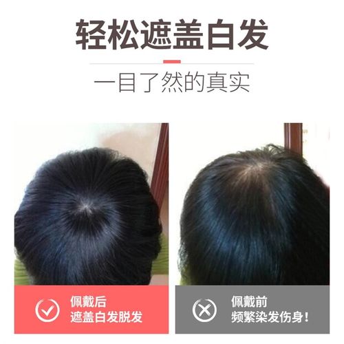 假发 女 头顶补发片遮白发假发片长发一片式全真发无痕隐形刘海片