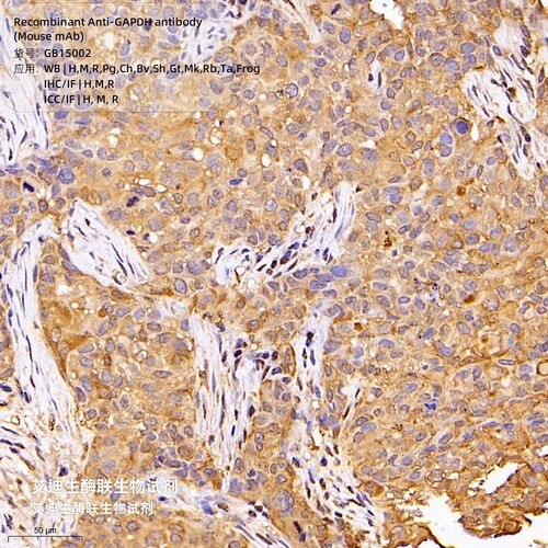 甘油醛-3-磷酸脱氢酶Recombinant Anti-GAPDH antibody,Mouse mAb