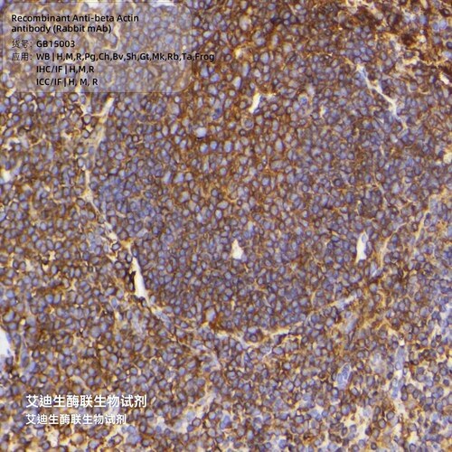 胞质肌动蛋白1,内参抗体,重组 Anti-beta Actin antibody,兔 mAb