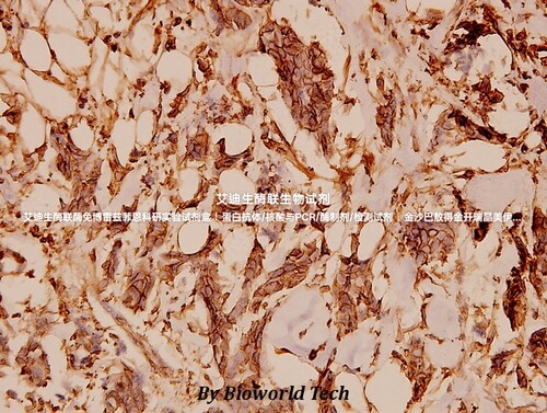 Bioworld 内参抗体 微管蛋白α(G436)/微管蛋白α(9H4)单克隆抗体
