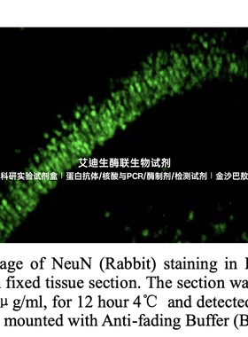 Bioworld免疫组化辅助试剂  兔抗绵羊FITC / TRITC荧光二抗试剂盒