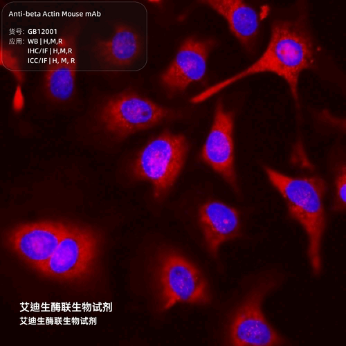 Anti-beta Actin Mouse mAb，胞质肌动蛋白1，内参抗体，一抗