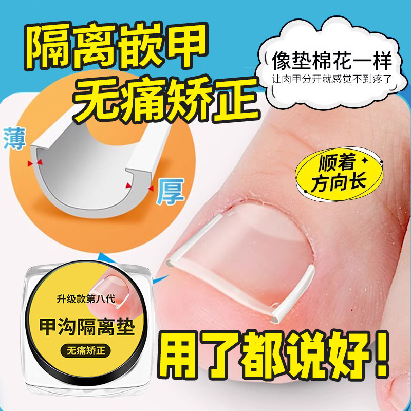 嵌甲矫正器正甲贴隔离填充垫片