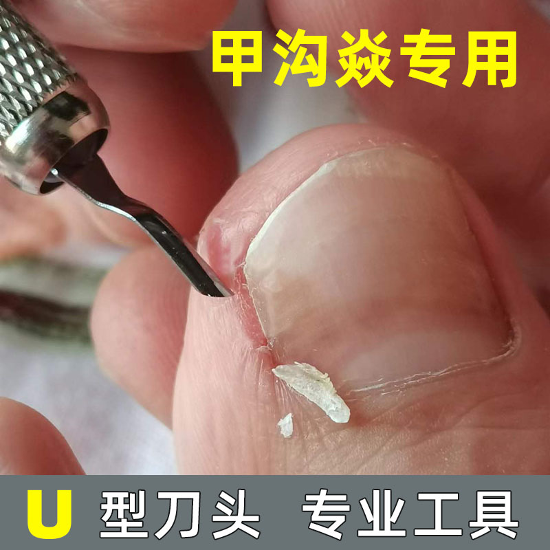 云格森甲沟焱修甲刀嵌甲刀扎肉疼