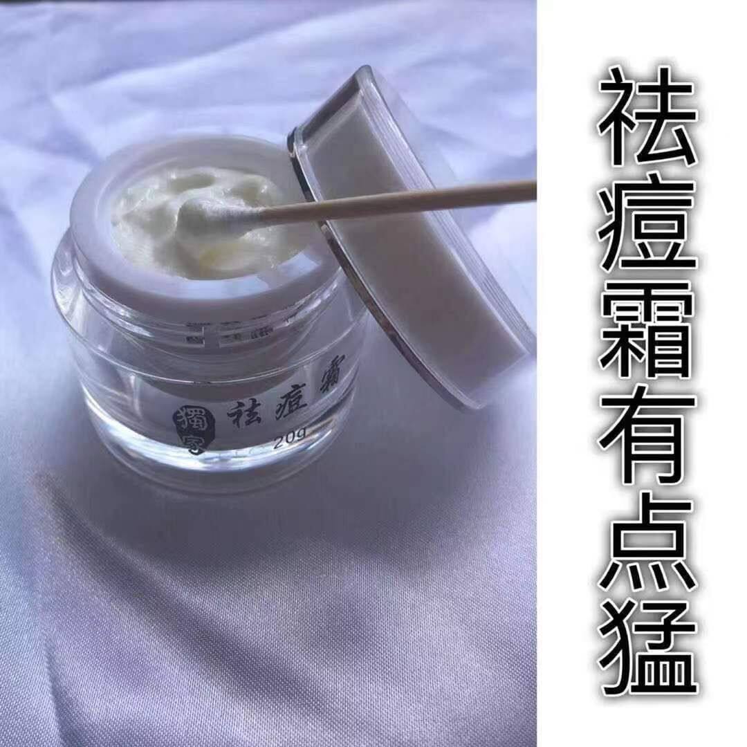 祛痘膏淡化痘印粉刺闭口青春痘上火痘男女学生均可用无痕祛痘霜