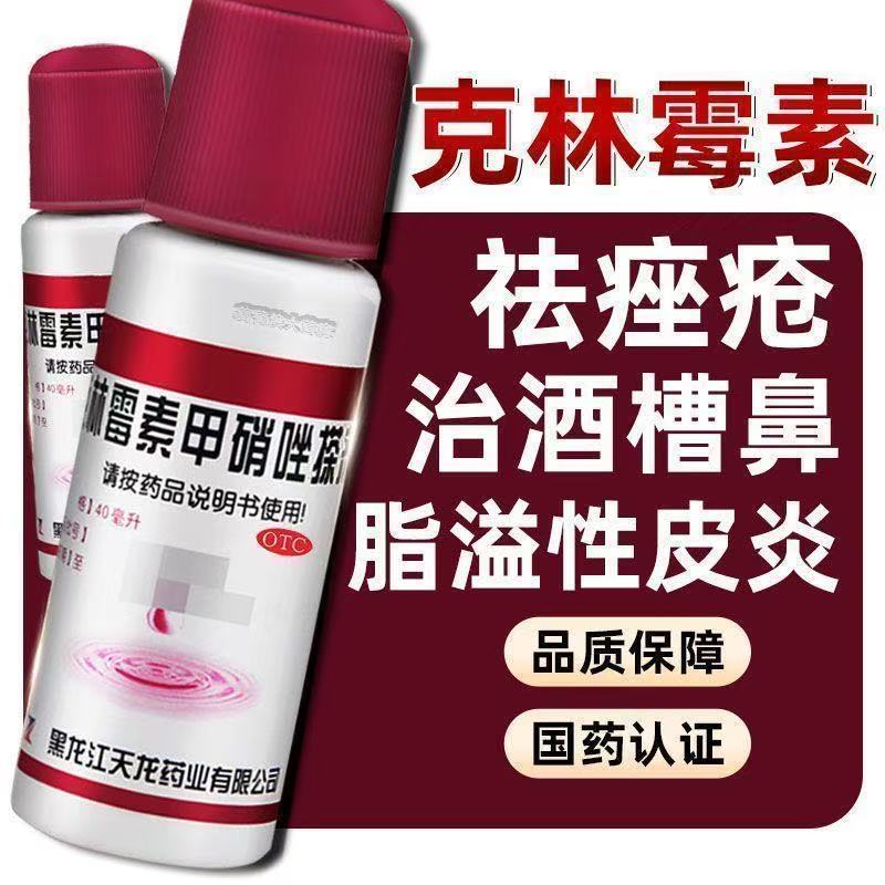 天龙克林霉素甲硝唑搽剂40ml痘痘脂溢性皮炎酒渣鼻毛囊炎寻常痤疮