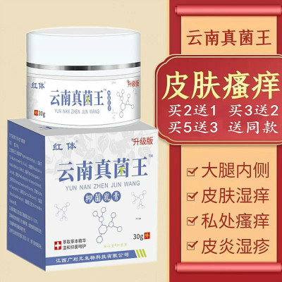 伊曲康挫真菌软膏挫唑乳膏真菌