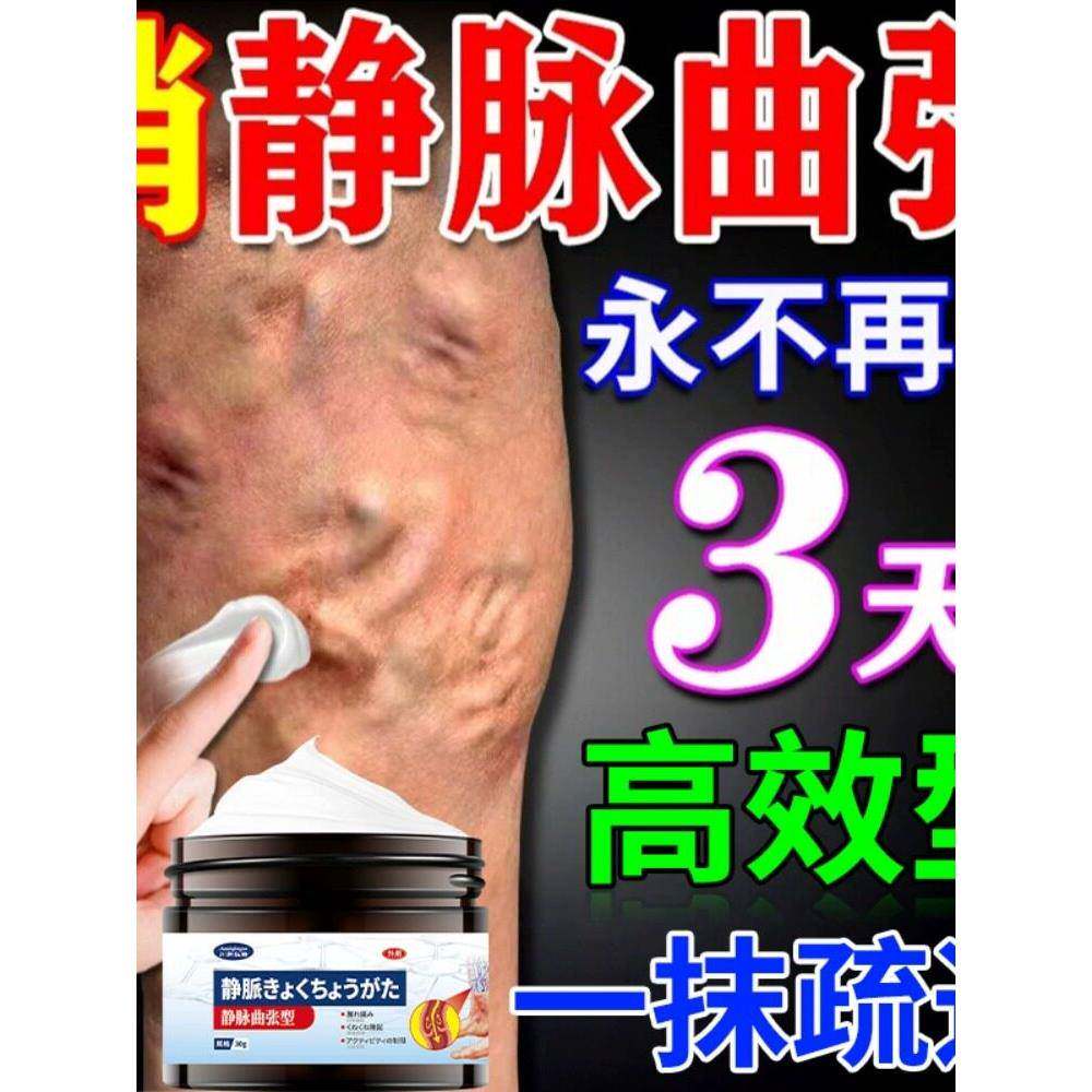 静脉曲张膏官方旗舰店静脉炎贴膏脉管炎老烂腿青筋凸起筋脉曲张膏