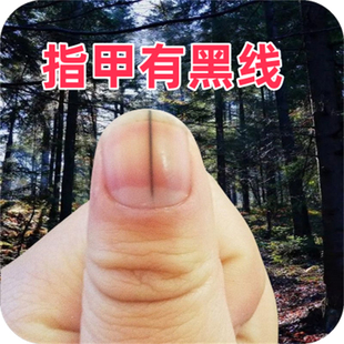 手指甲中间裂缝裂口指甲盖竖纹指甲中间开裂指甲凹凸不平修复护理