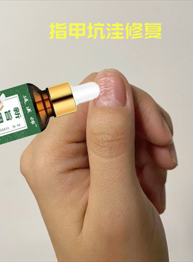 指甲黑色竖纹黑线手指甲真菌感染指甲里面有黑线手指甲护理修复膏