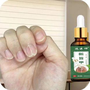 指甲黑色竖纹黑线指甲里面有黑线手指甲凹凸不平修复通用修护药剂