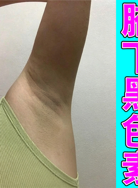 腋下黑色素沉着淡化黑皮肤腋下去黑腋窝去黑色素沉淀淡化
