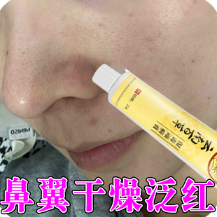 鼻子两侧干燥泛红面部鼻子两侧发红起皮酒槽鼻