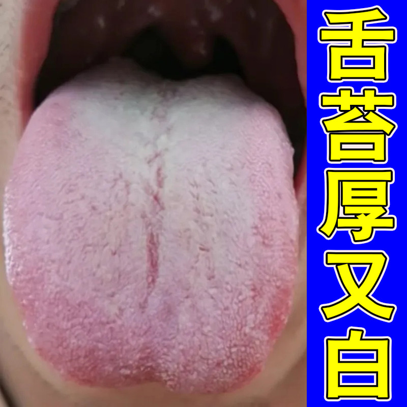 冶舌苔白厚口臭调理肠胃健脾祛肝皮肤消毒护理（消）