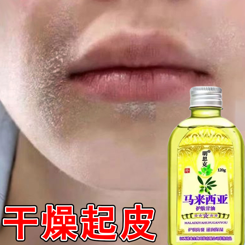 脸上干燥起皮脱皮脸干痒嘴边干皮掉皮屑脸部皮肤粗糙爆皮起干皮屑