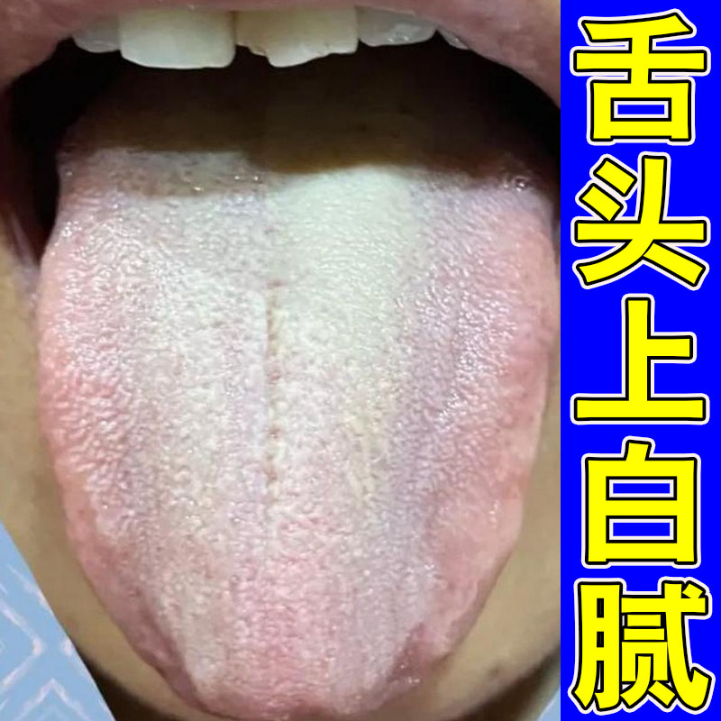 舌苔白厚黄腻口苦口臭舌头发苦发皮肤消毒护理（消）