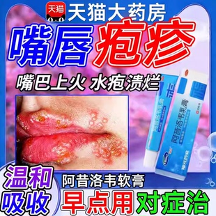 阿昔洛韦软膏带状疱疹唇炎水痘专用乳膏外用药膏正品官方旗舰店