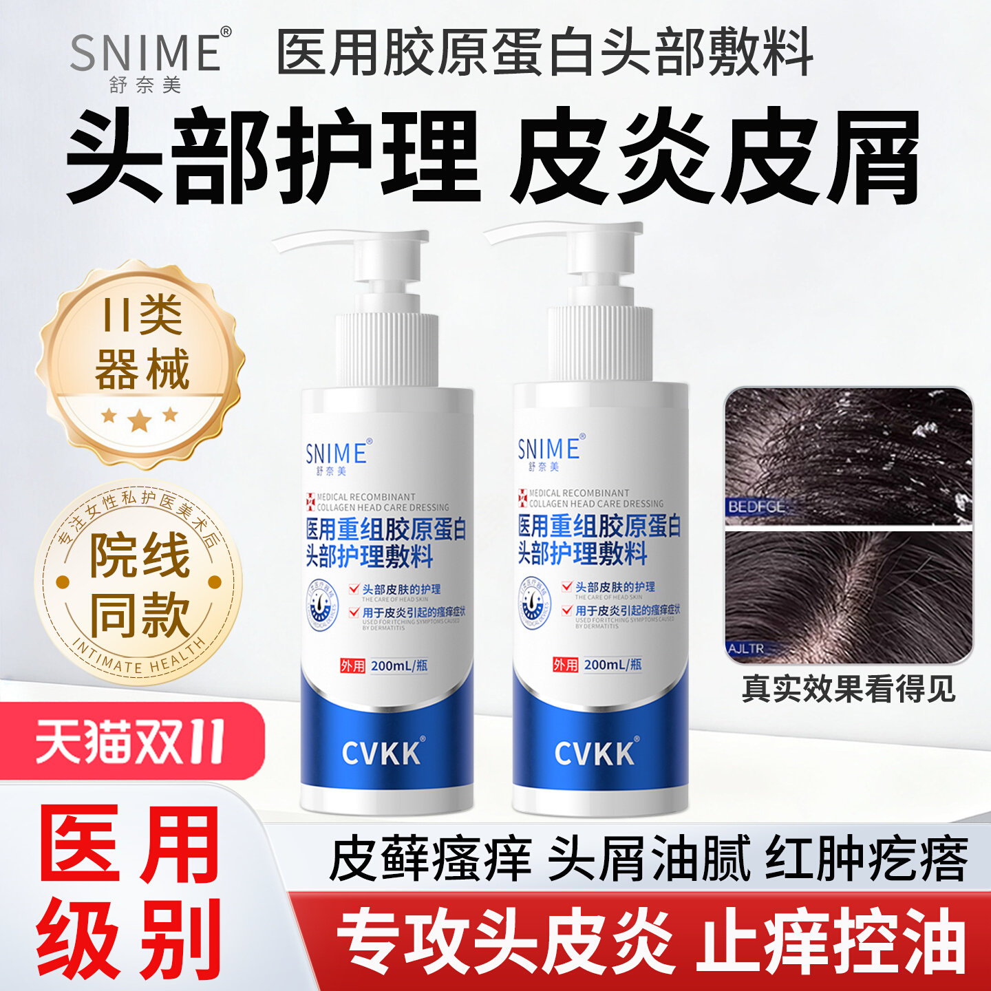 医用头部护理敷料脂溢性非洗发露