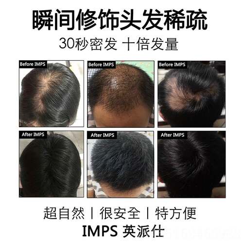 高档IMPS发充增际线填浓密增美发补发神器密发发假发粉头发多少纤