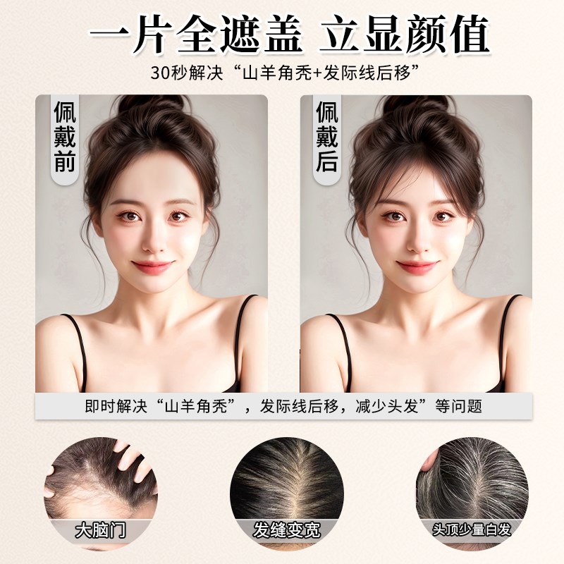 假发女片头顶真发蓬n松高颅顶增发量遮白发轻薄八字刘海补发片