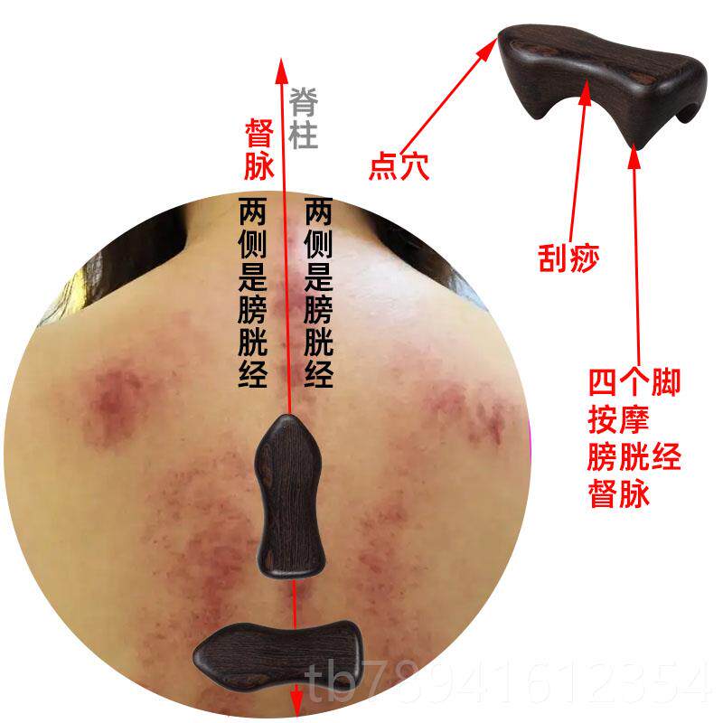 高档经络按摩狗推按摩器工具背部经络疏通按拿摩虎动力脊柱按摩器