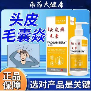 头皮发痒半夜痒醒越抓越痒脱屑头皮发红乳膏