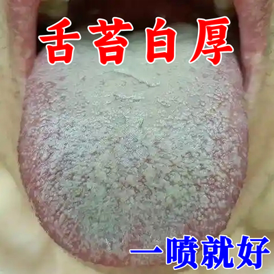 舌苔白厚脾胃健湿气祛口