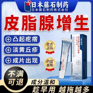鼻子鼻翼两侧小肉疙瘩粟丘疹皮脂腺增生异位症脸上起脂肪小颗粒