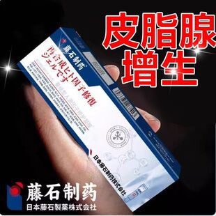 藤石制药面部鼻子皮脂腺增生去除膏鼻翼凸起小疙瘩肉粒脸部