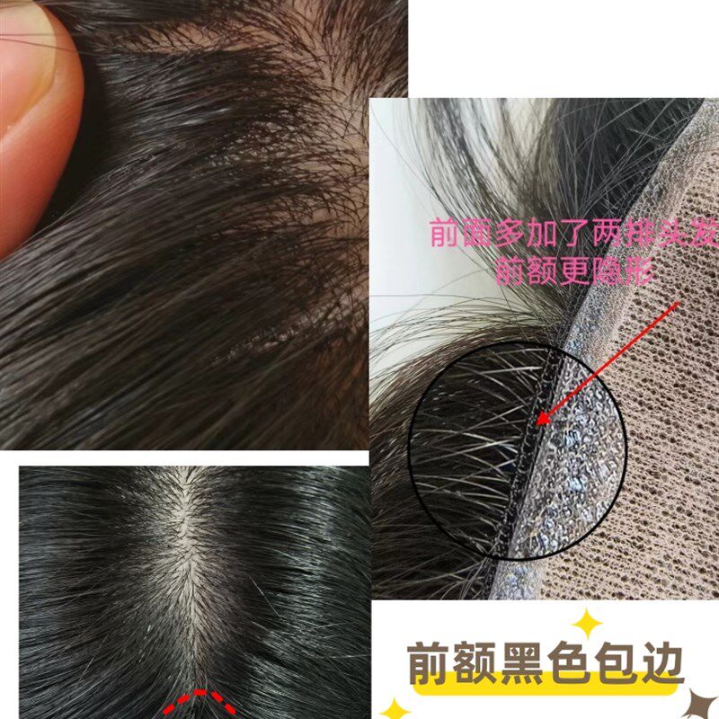 顺心假发真人发丝头顶补发片遮挡白发少染发女神补发片