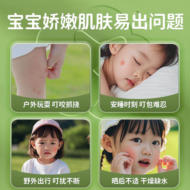 紫草膏防蚊虫叮咬婴儿专用婴孕可用温和精萃缓痒消包便携式青草膏