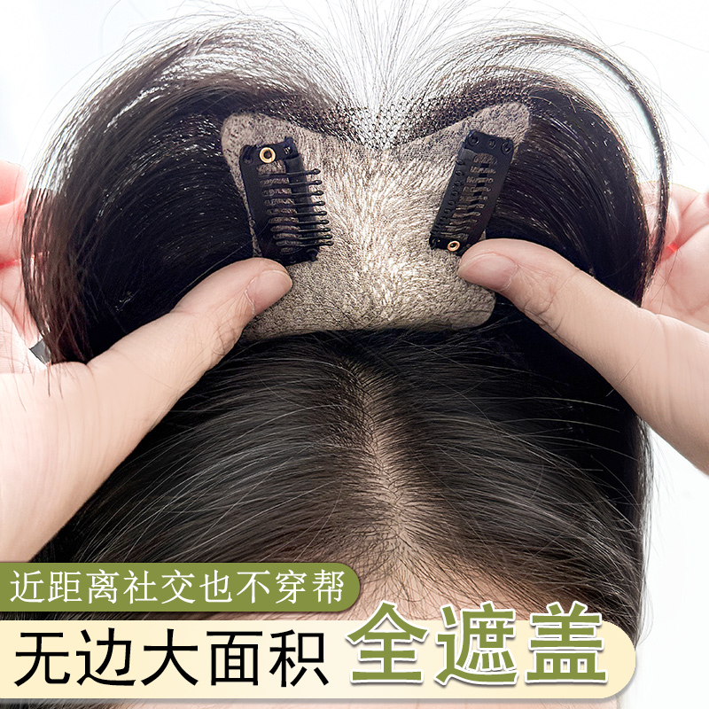 【亚兰帝】头顶假发补发片