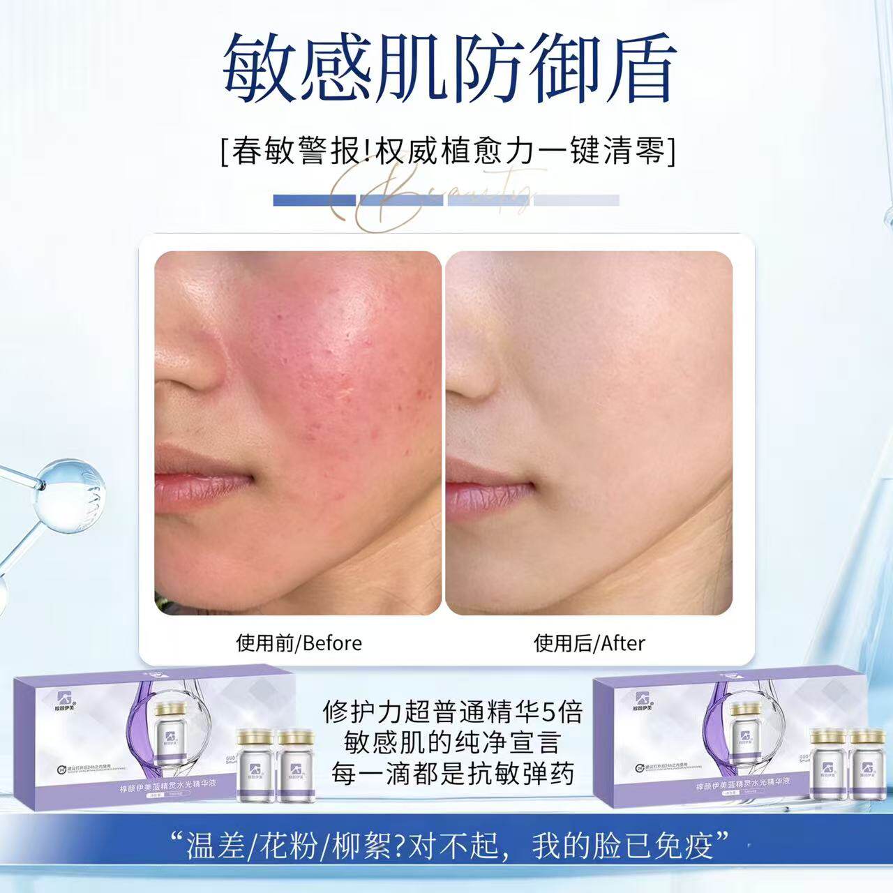 科立美抗痘蓝精灵水光精华液抗炎K敏修复急救