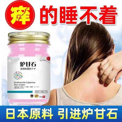 进口炉甘石特效止痒膏湿疹荨麻疹牛皮癣瘙痒中老年人全身皮肤干痒