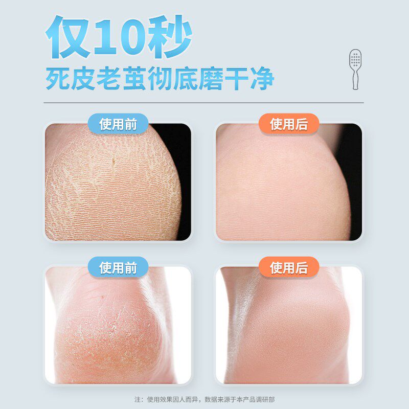 磨脚棒脚皮打磨器去死皮神器脚刷子擦搓脚板摸脚跟磨脚去老皮工具