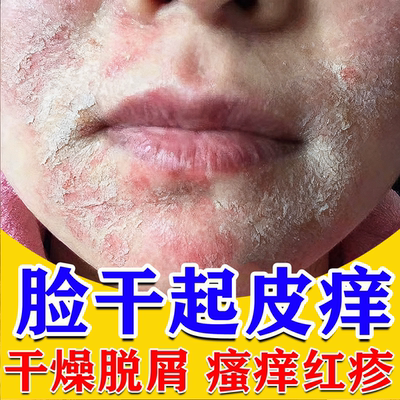 【三顺】参皇软膏30g*1支/盒