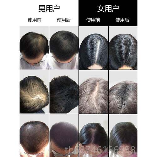 正品FPUMP增发头发维纤密粉假发男女密发粉美补发浓发发发增浓密