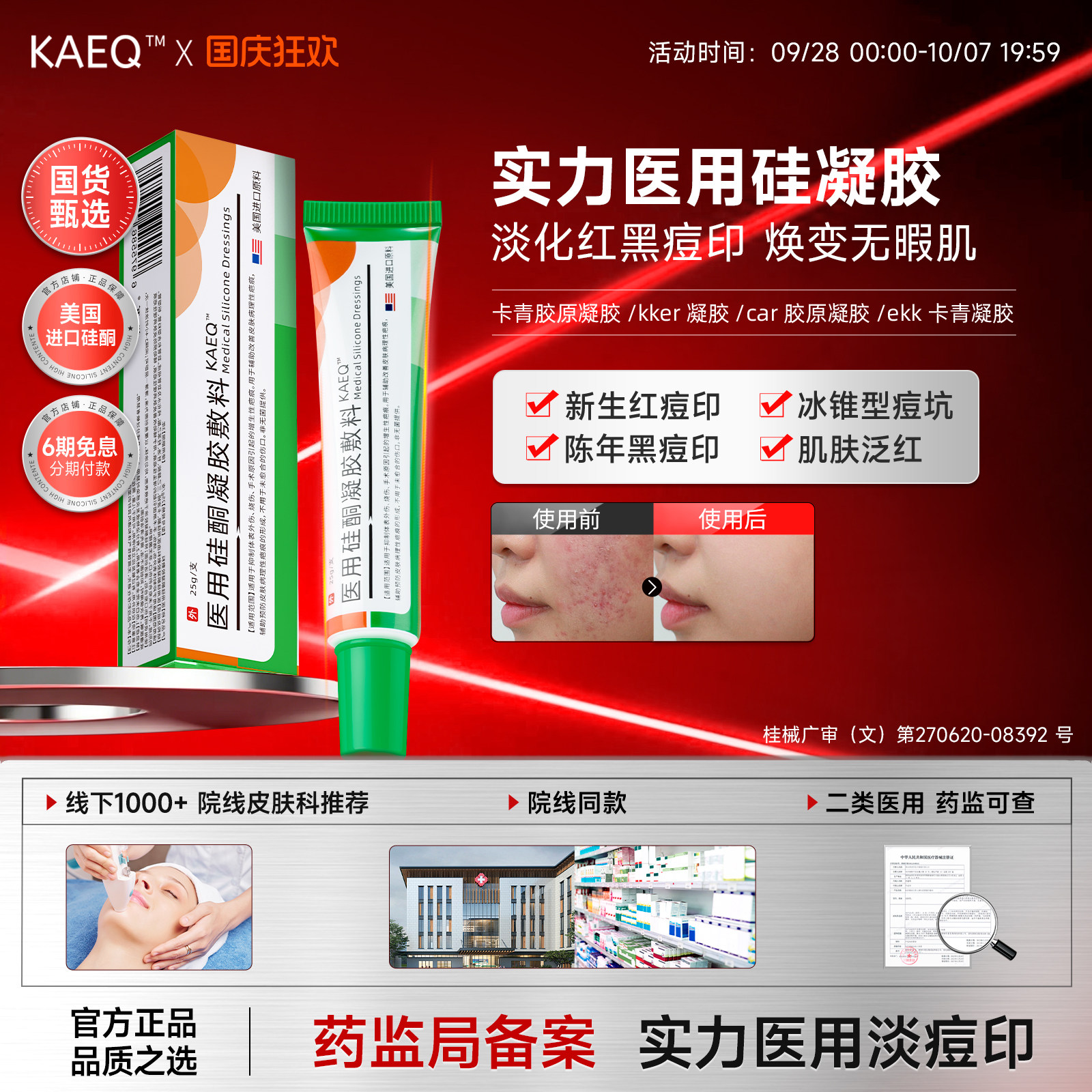 【医用淡痘】卡尔清医用硅酮凝胶淡化痘坑痘印淡化黑色素沉淀正品