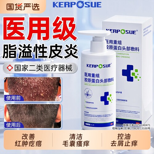 脂溢性皮炎洗发用水销量NO.I