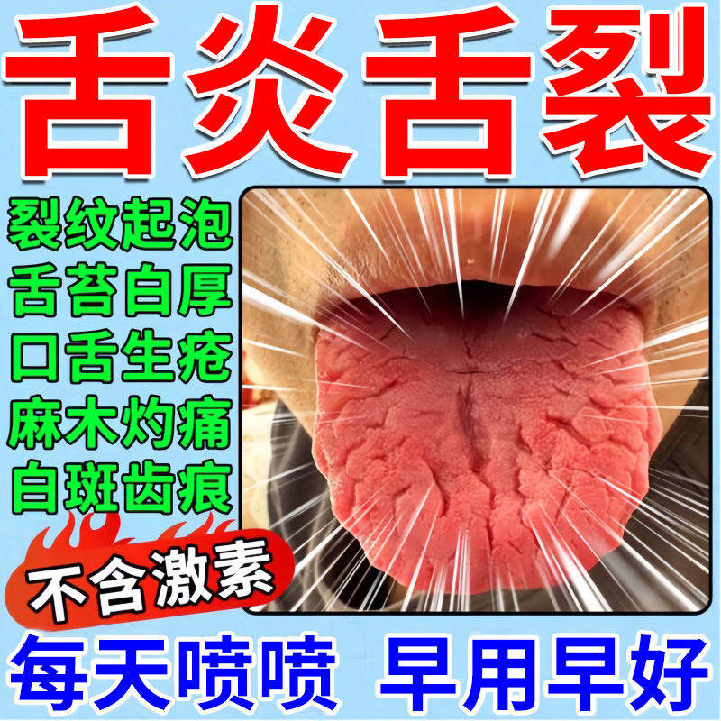 【舌头裂纹有齿痕】舌苔白厚喷剂