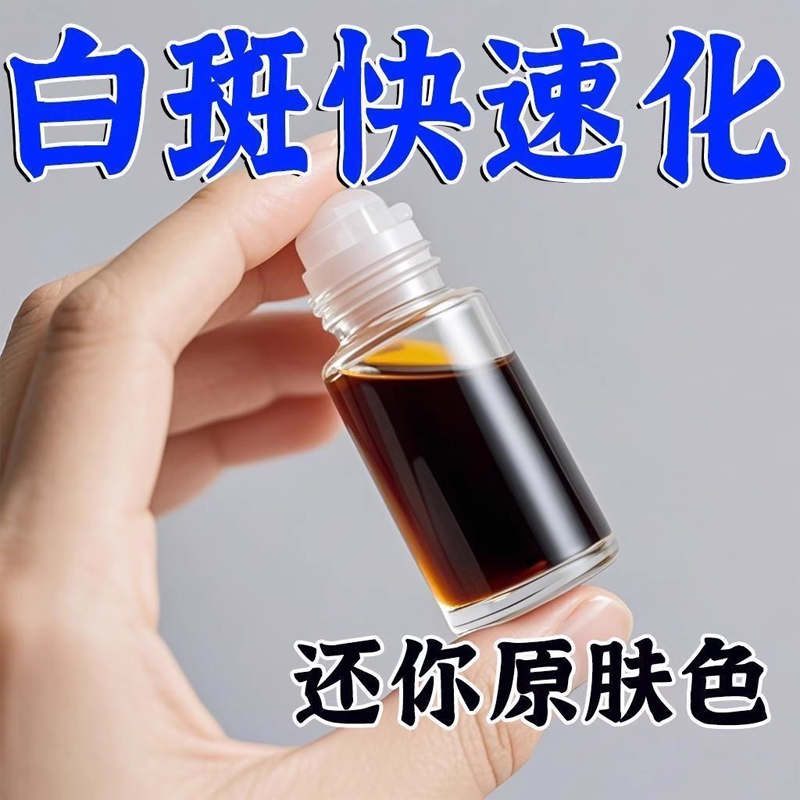 【小红书爆卖】白巅风外用白斑花斑促黑色素软药膏补骨脂汗斑膏用