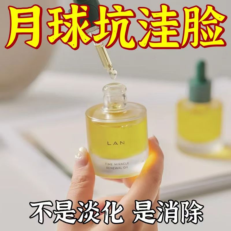 祛痘印修复淡化痘印祛痘膏痘坑男生女痘消闭口炎粉刺克星面霜国货