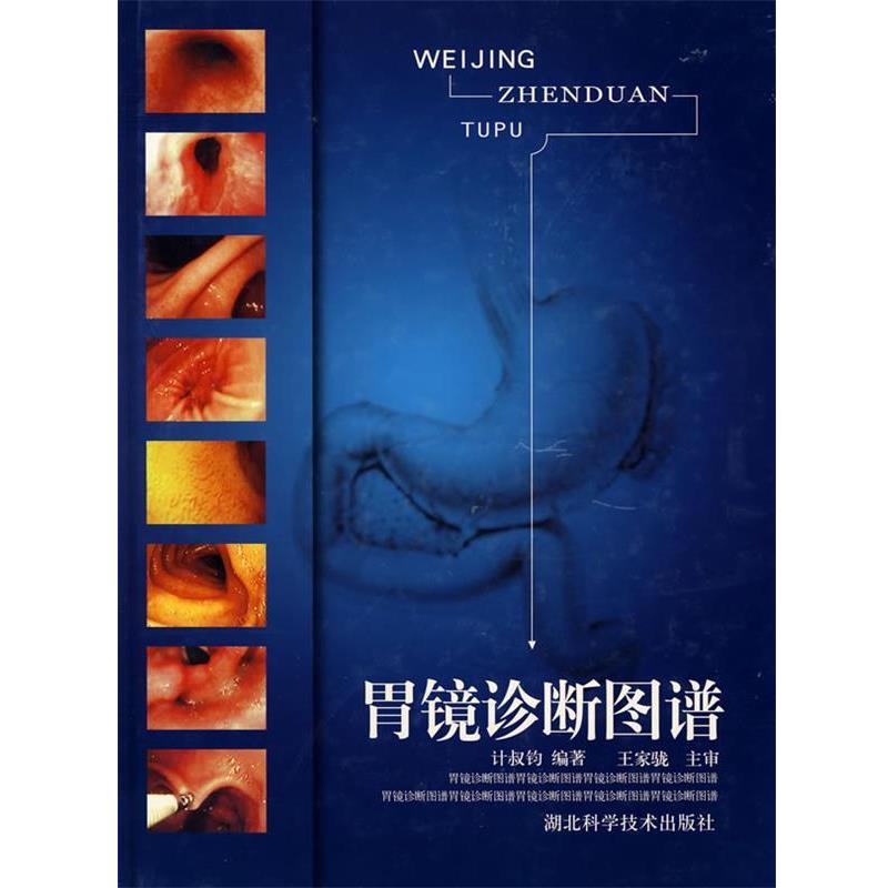 【正版书】 胃镜诊断图谱 计叔钧 编著 湖北科学技术出版社